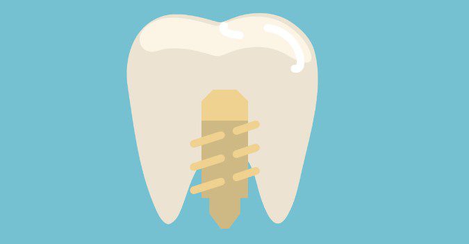 Безметалловая керамика от стоматологии «Студия улыбки» 1 139885315 16185741293211n 2